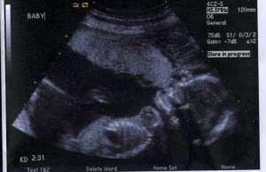 My son JJ in my womb